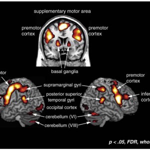 Image from Grahn, J. A., Henry, M. J., & McAuley, J. D. (2011). FMRI investigation of cross-modal interactions in rhythm perception: Audition primes vision, but not vice versa. NeuroImage, 54(2),1231-1243.